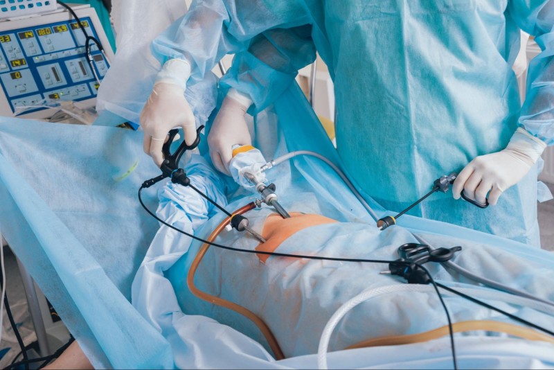 Laparoscopy for Endometriosis: A Minimally Invasive Solution for a Painful Condition